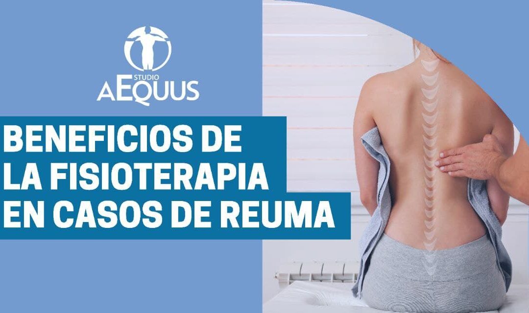 Beneficios de la fisioterapia en casos de reuma