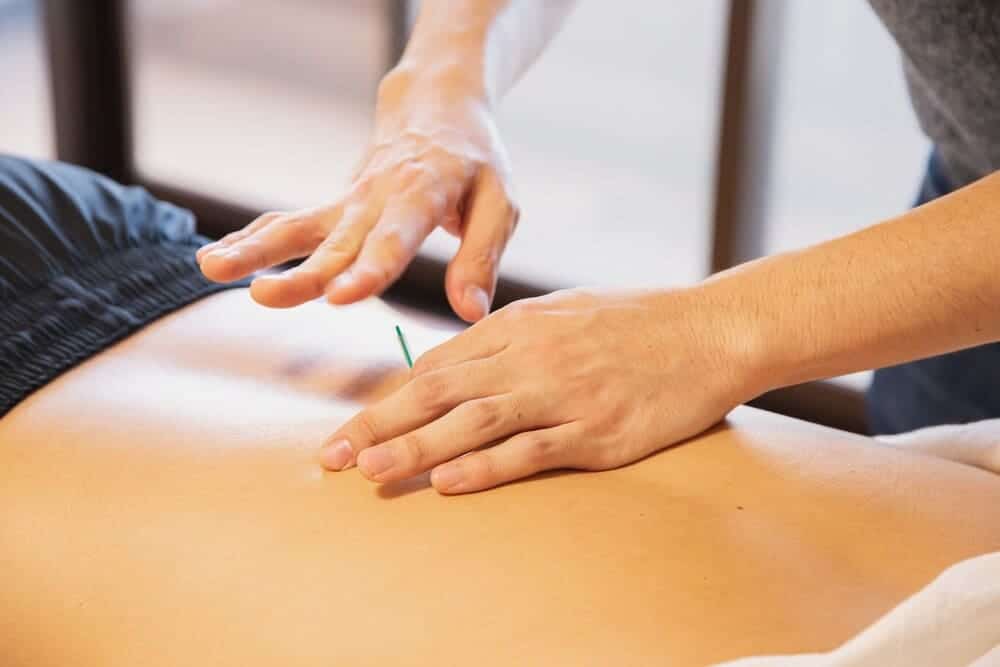 terapeuta realizando tratamiento con aguja acupuntura a paciente